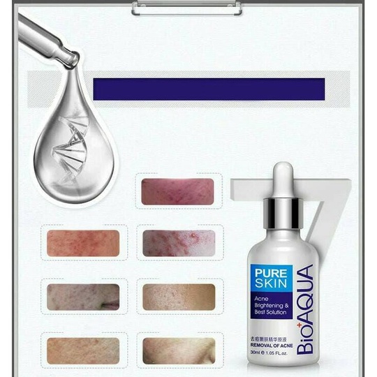 Сыворотка от акне Pure Skin